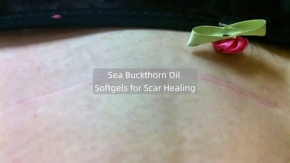 I Took Sea Buckthorn Oil Softgels for My Scar